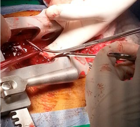 EcqlYvrm197QIrca.png 3.png.png