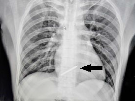 IdFDMyfr2kgoTkNr.png 1.png.png