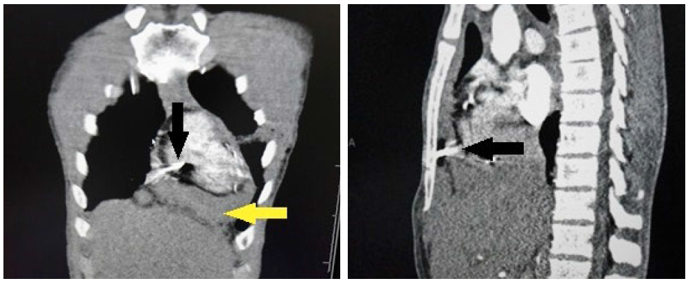 JIO3CGch5mmDcALV.png 2.png.png